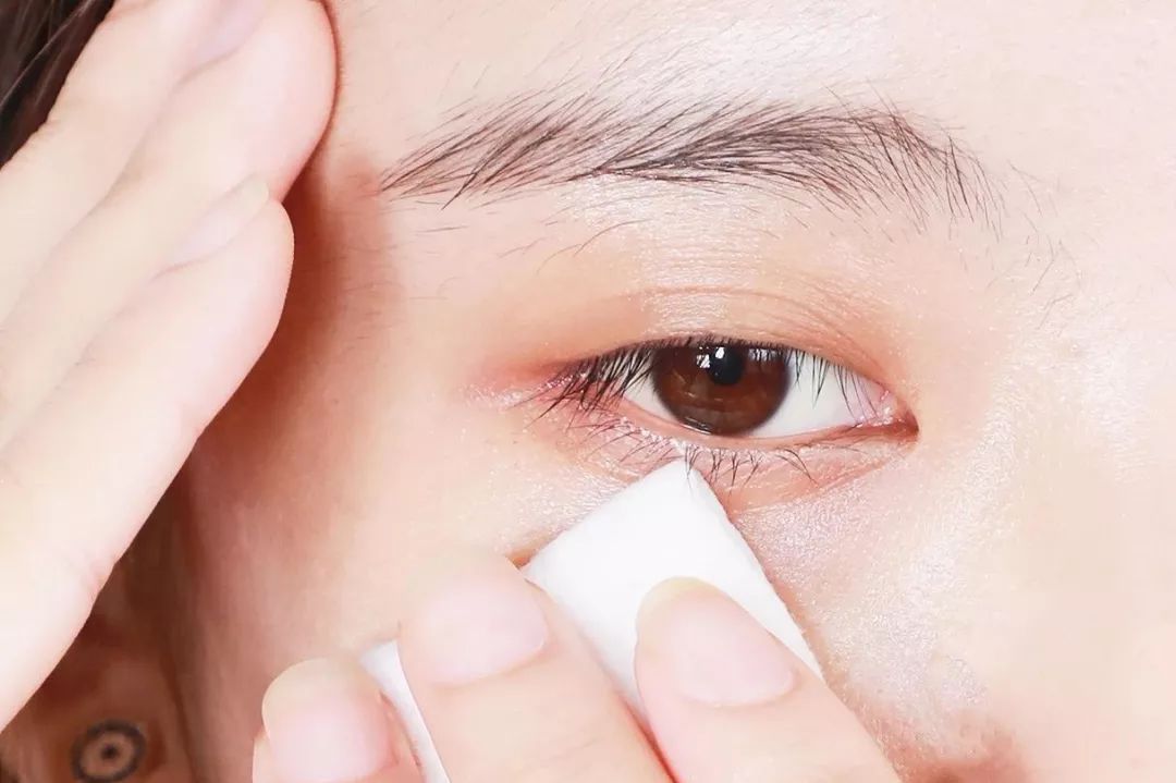 用棉签清理内外眼角,避免眼睑堆积残留的睫毛膏渣滓