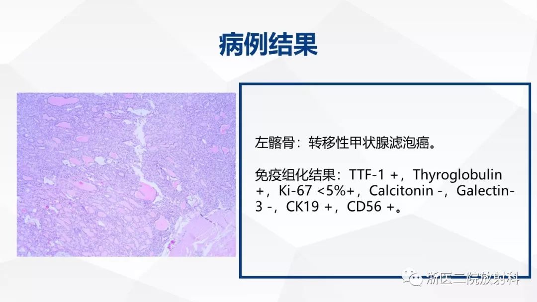 骨肌組病例及解析 | 浙醫二院病例討論會(第四期)_徐雷鳴