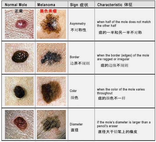 什么是痦子什么是痣图片