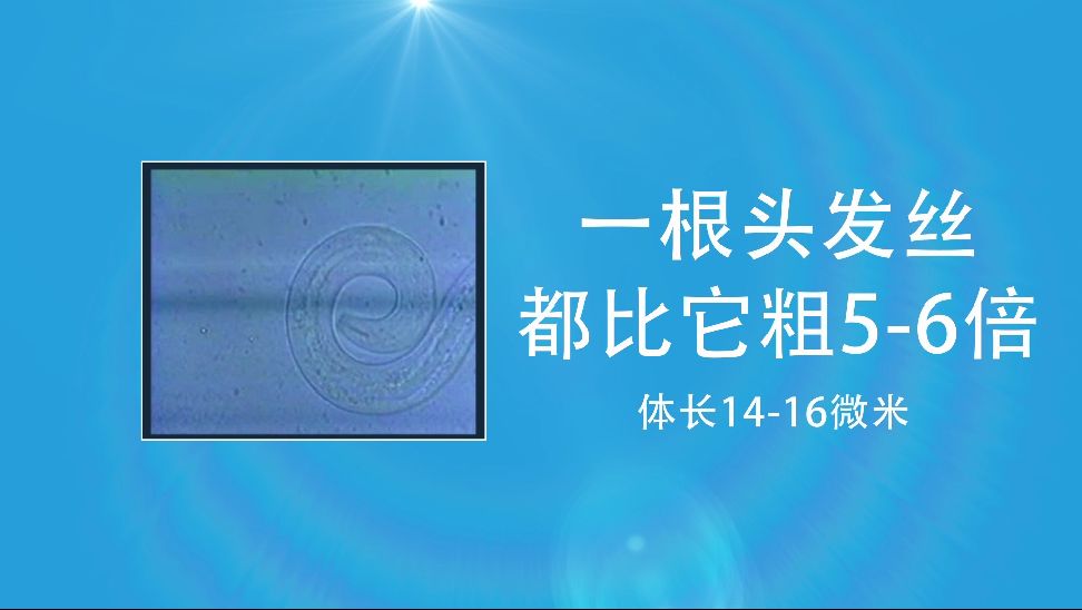 松材线虫只有14到16微米,一根头发丝都比它粗5