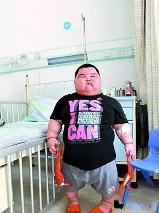 三岁120斤中国最胖儿童小豪的日常