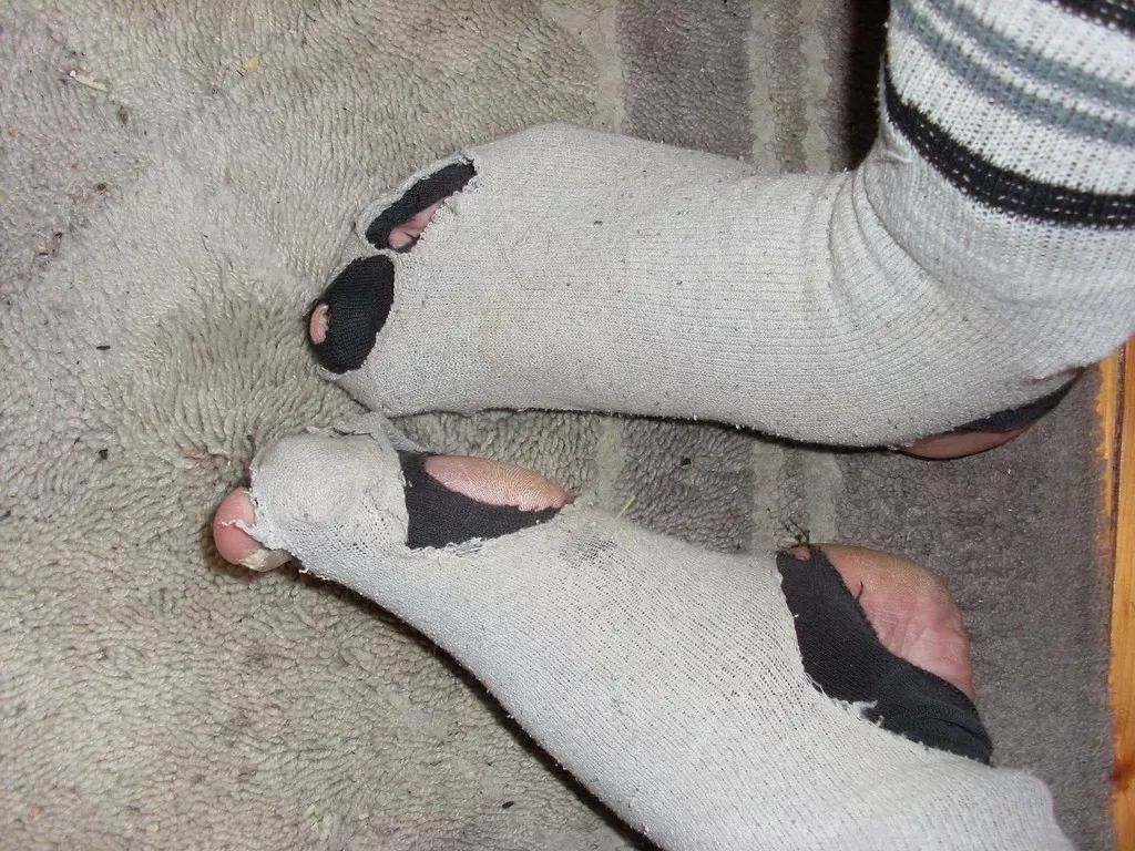破袜子漏脚趾头图片图片