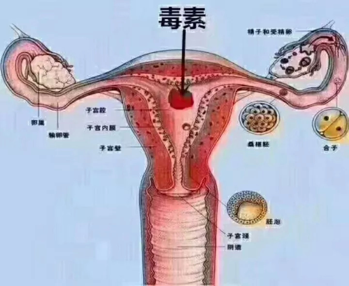 女性滴虫病图片 症状图片