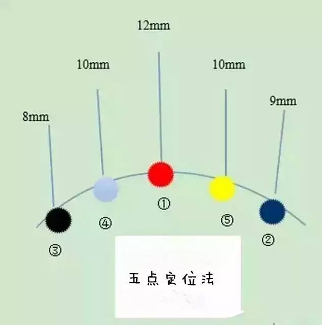 五点定位嫁接法图解图片