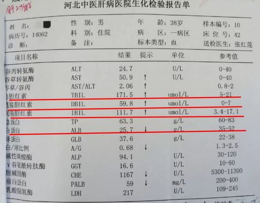 驚險38歲小夥兒肝腹水命懸一線他能否轉危為安