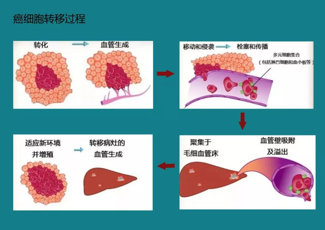 《叢玲帶你看名醫》| 腫瘤肝轉移≠生命倒計時