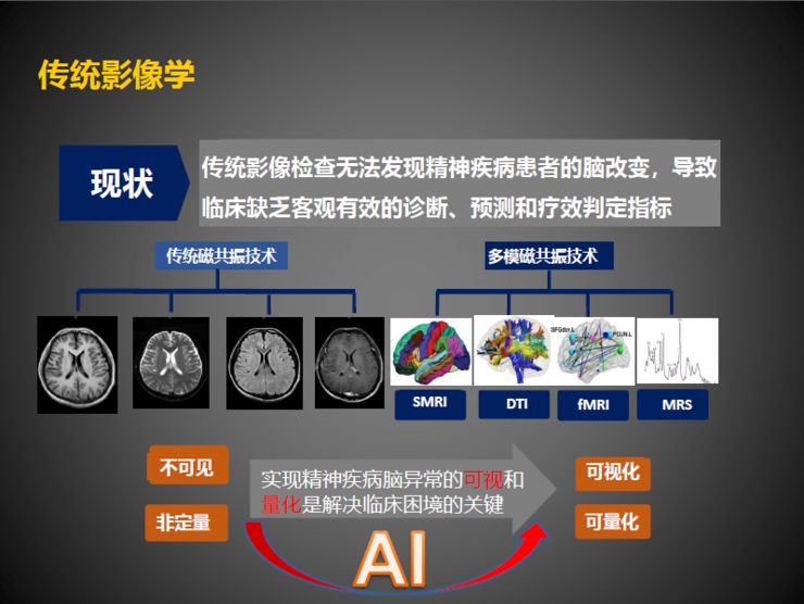 華西醫院副院長龔啟勇腦醫學與人工智能發展前沿丨cmai2018