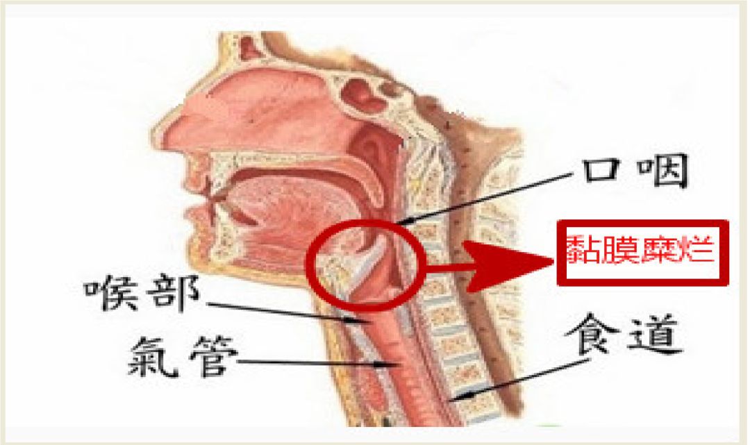 气管与胃管的结构图图片