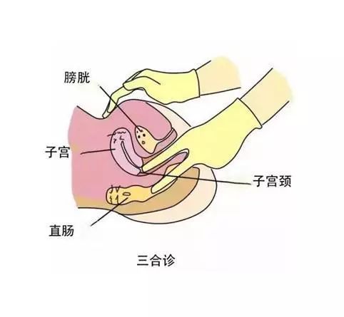 食指置于阴道内,另一只手置于下腹部,可以更进一步触诊子宫颈以及子宫