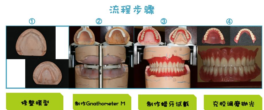 生物功能性全口义齿技工操作流程展示
