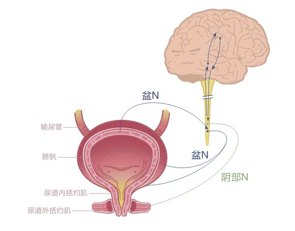 膀胱输尿管反流图片