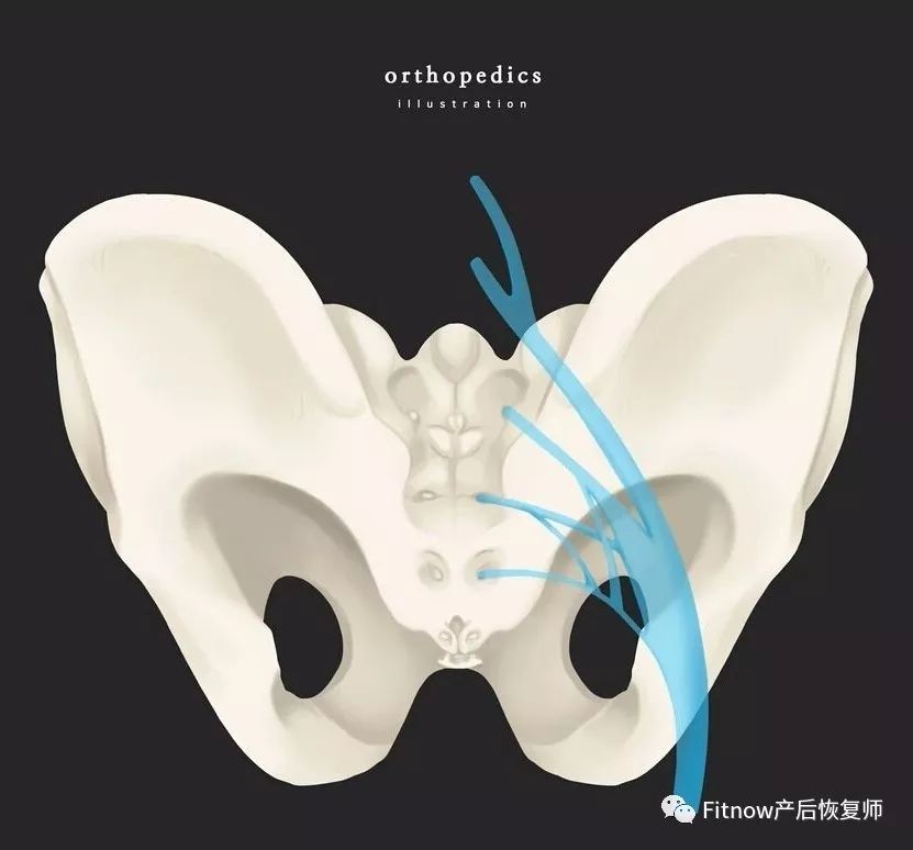 產後疼痛你不瞭解的梨狀肌