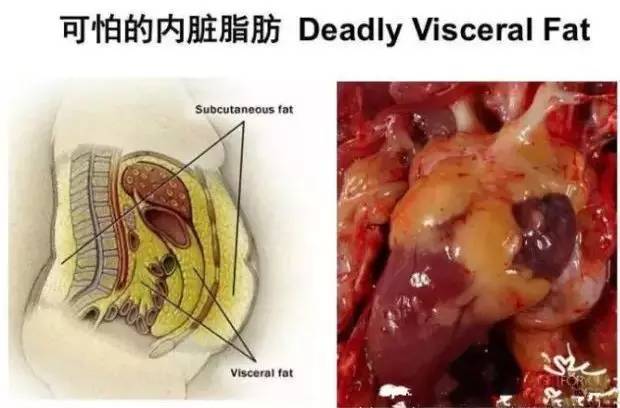 人的脂肪是什么样子的图片