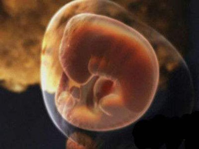 怀孕1个月胎儿和孕妇的变化有哪些?疾病重点:排查是不是宫外孕