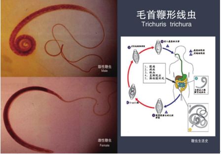 鞭虫生活史箭头图图片