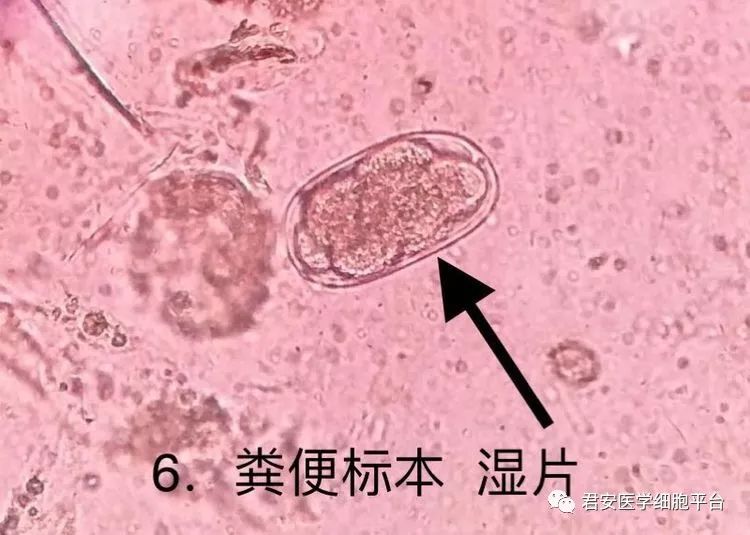 加特纳菌的典型图片图片