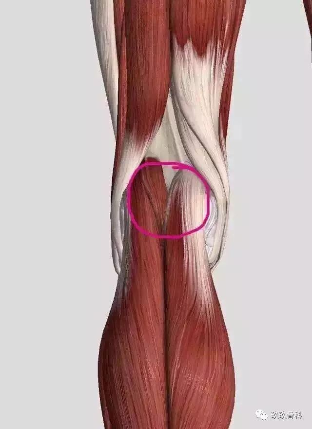 股二头肌痛图片