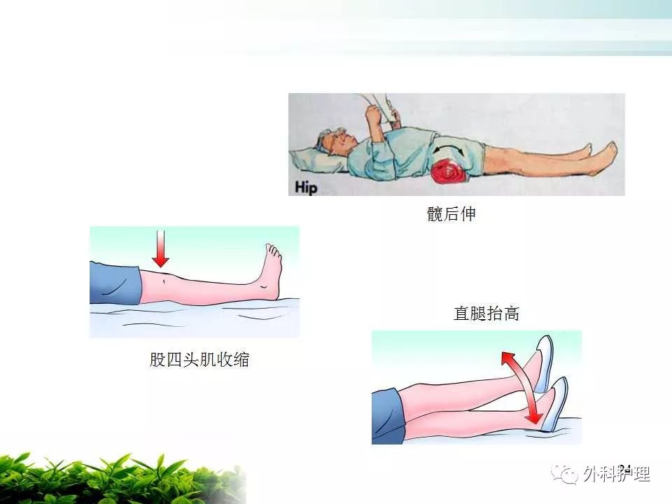 【ppt】股骨粗隆间骨折pfna的学习