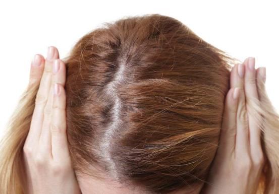 女生产后脱发,压力太大掉头发,怎么更快恢复?