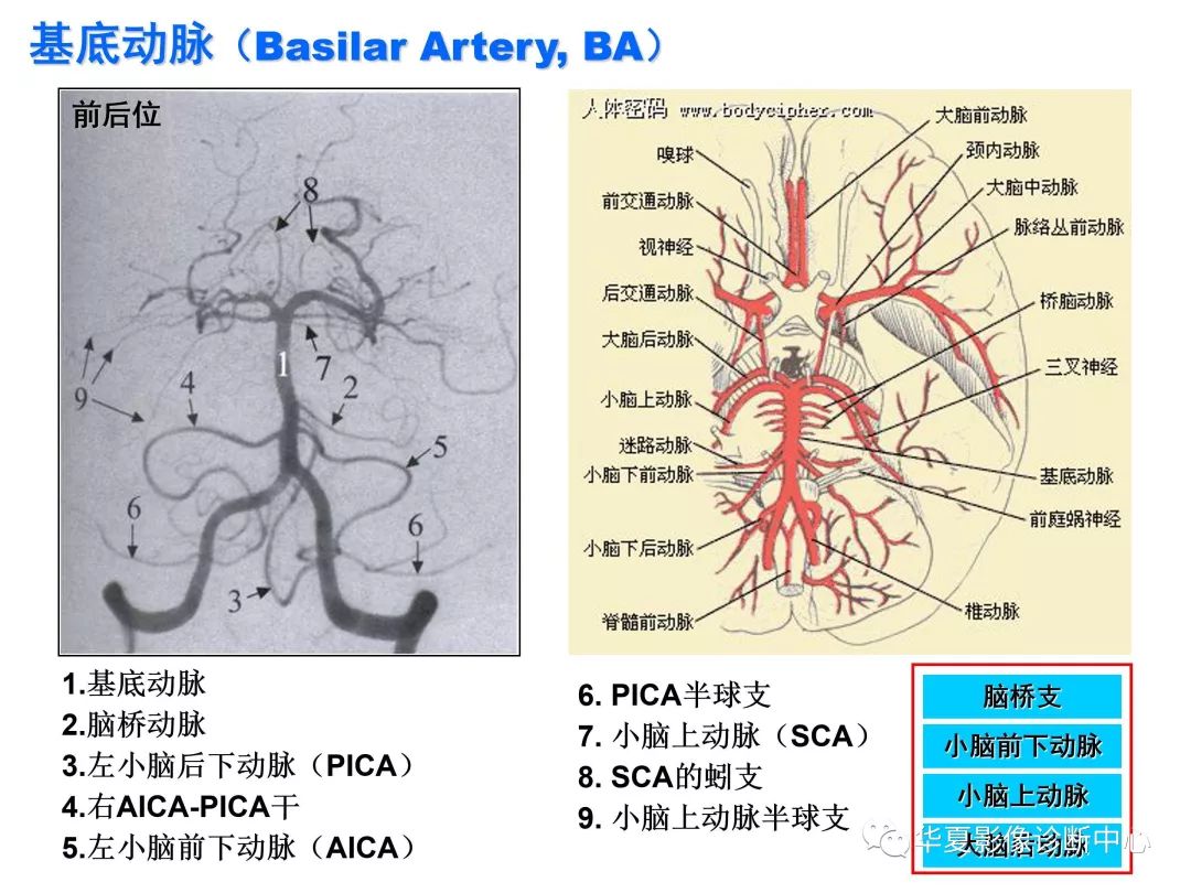 颅内动脉分段解剖图图片