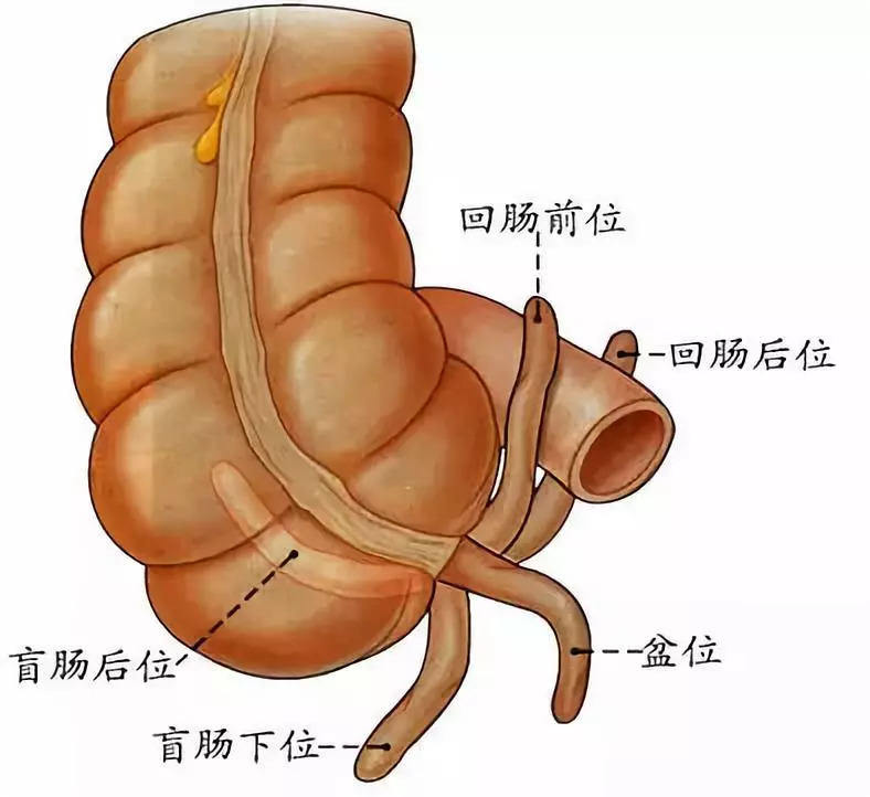 人体解剖阑尾的位置图片