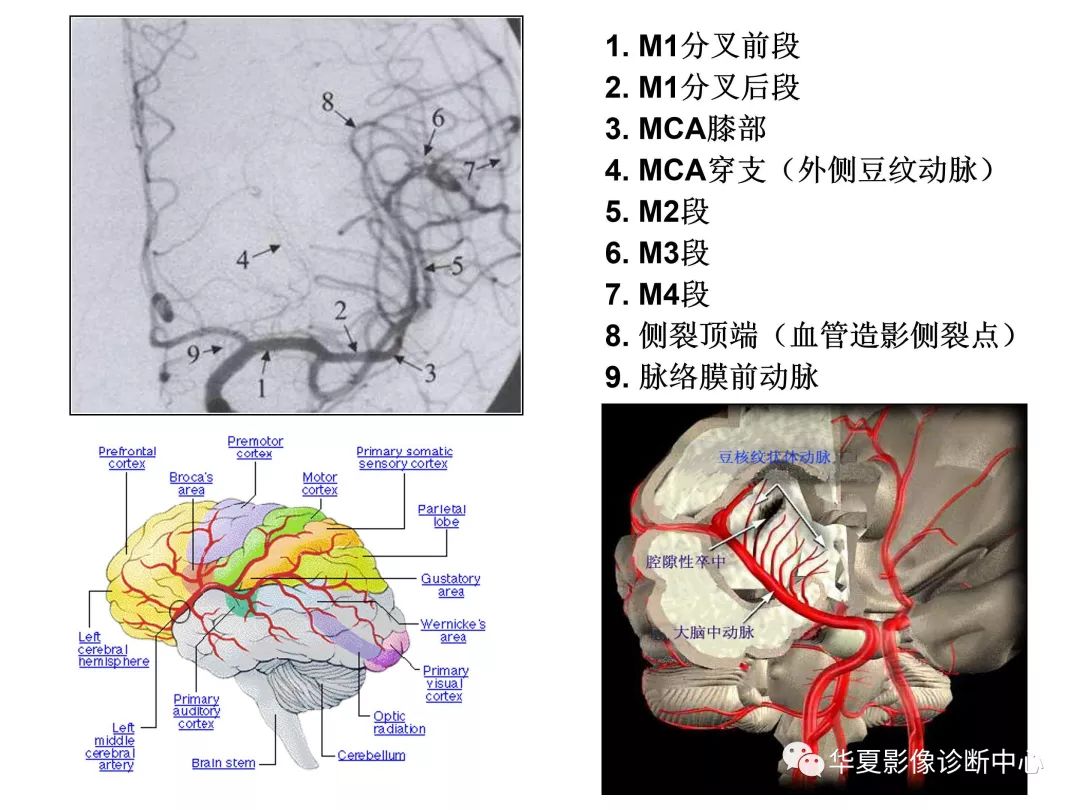 脑内动脉分段解剖图图片