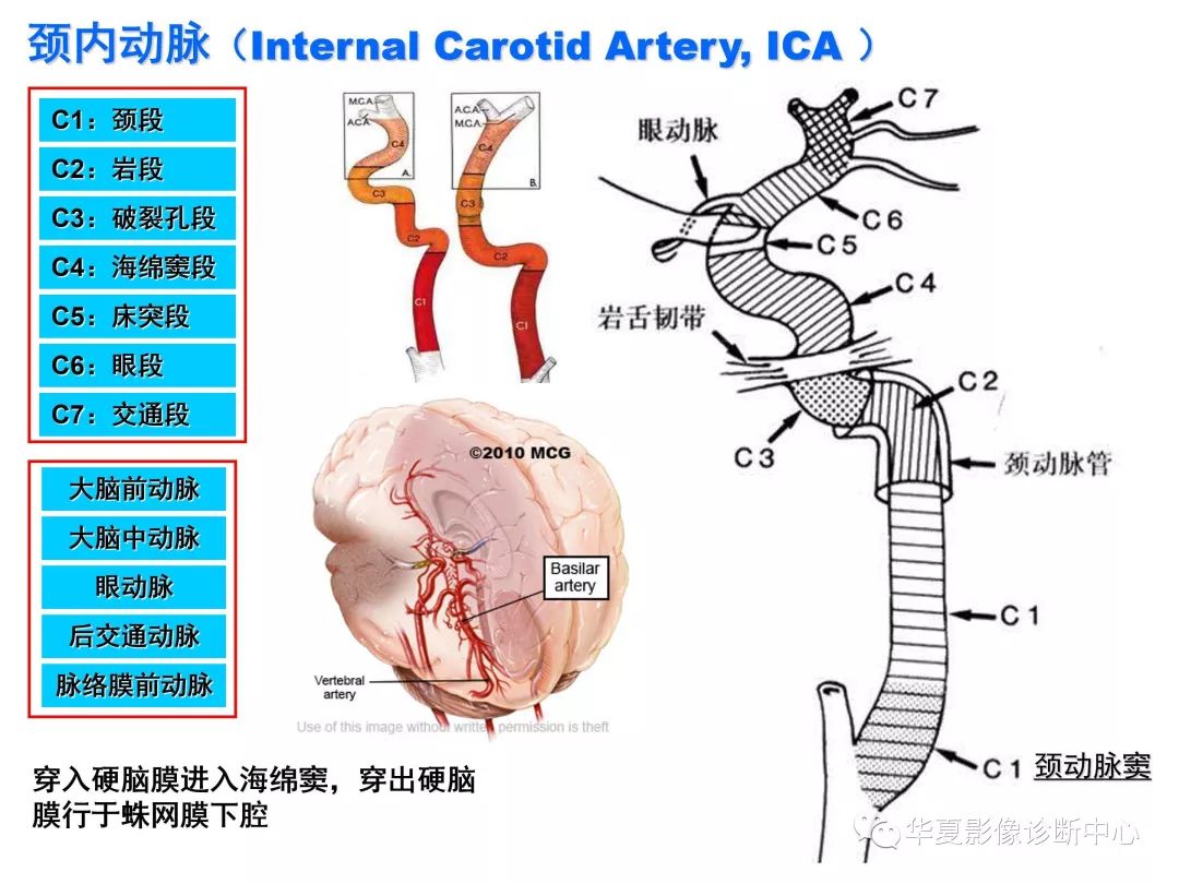 颅内动脉分段解剖图图片