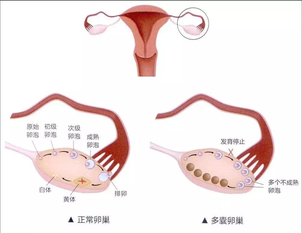 卵巢和懷孩子那點事兒