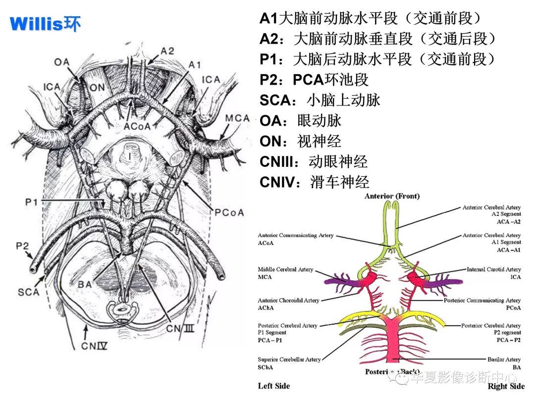 脑血管分段解剖图ppt图片