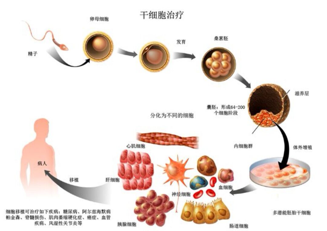 港泰幹細胞相信不需要多長時間幹細胞療法將在糖尿病的治療中逐步形成