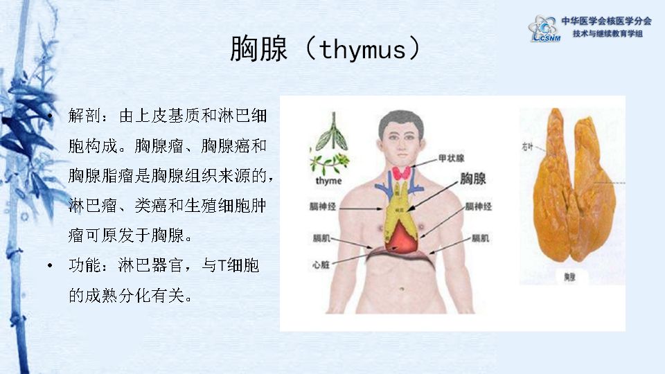 胸腺瘤位置图片图片