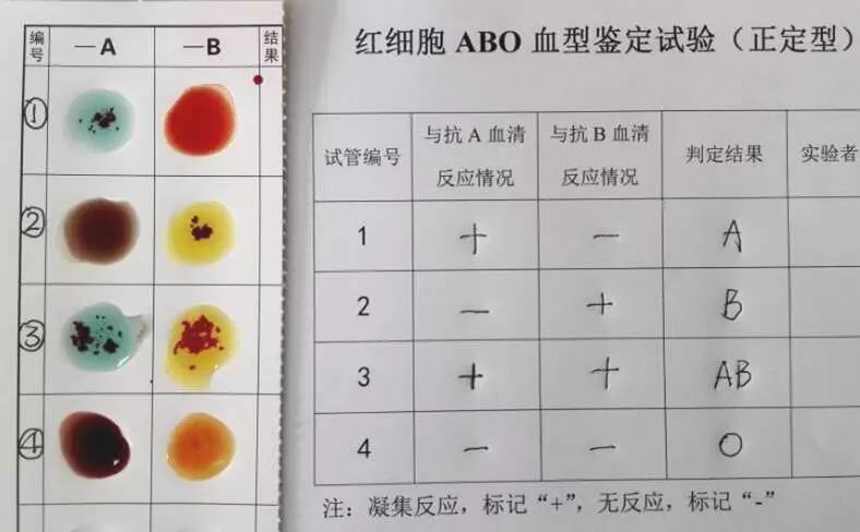 (abo和rh系统是主要的红细胞血型系统)血型系统04血型知识小科普3