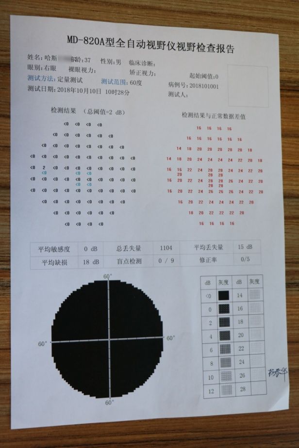 患者术前视野检查报告(左眼)