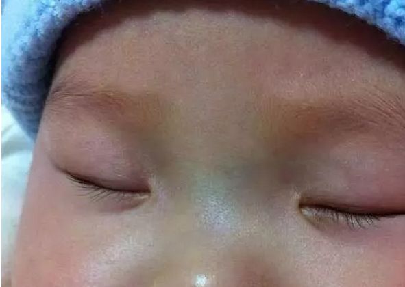 宝宝鼻梁变化图发育图图片
