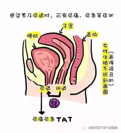 女人都有的一种烦恼,叫阴道炎