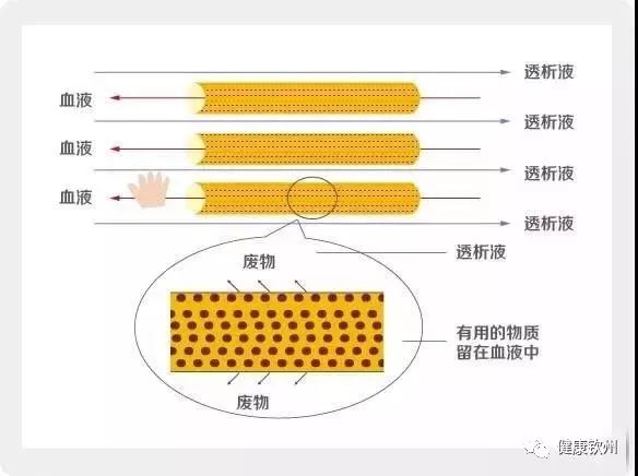 医学圈丨广西公布血液透析室技术评估合格名单,快查钦州的!