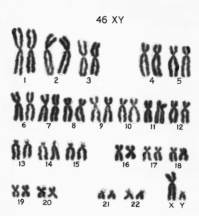 正常男性染色体图图片