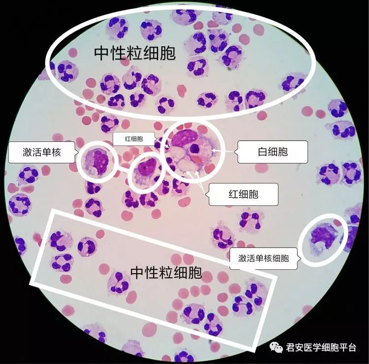 潘氏细胞染色图片