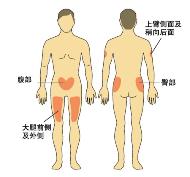 胰岛素打在什么位置图片