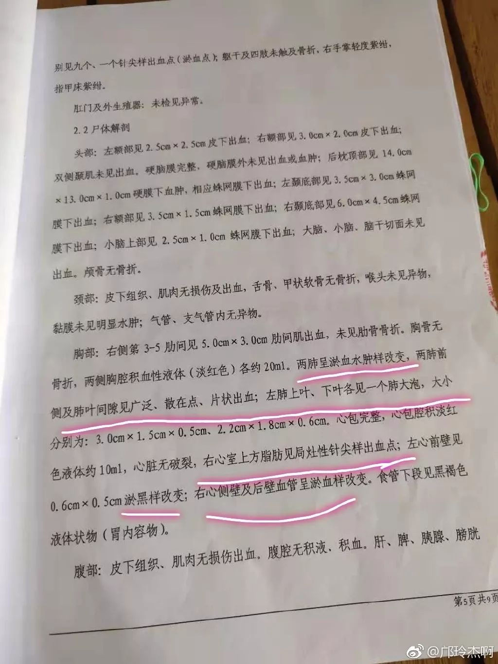 女尸检报告图片