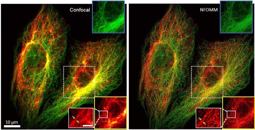 图3 共聚焦方法与nfomm方法观察细胞微管和波形蛋白双色样品的对比