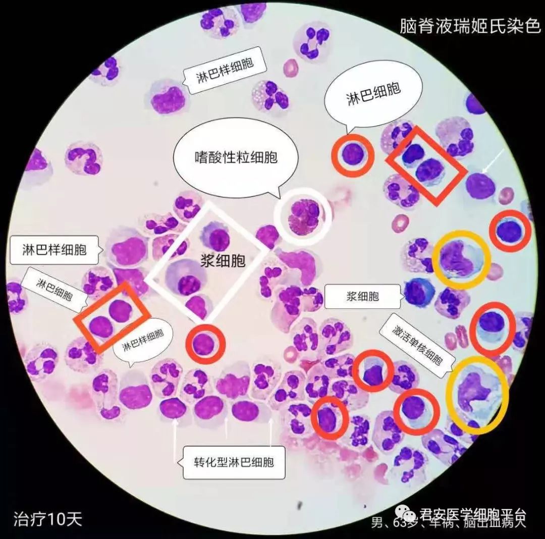 潘氏细胞染色图片