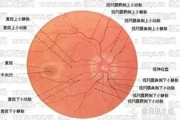 治療的總體目標是:防止新生血管的產生,尤其是防止新生血管性青光眼的