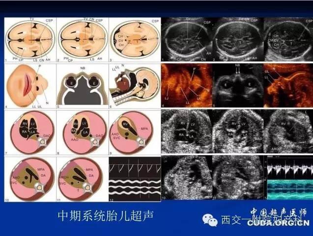 用羊水最大深度或羊水指数评估羊水量;