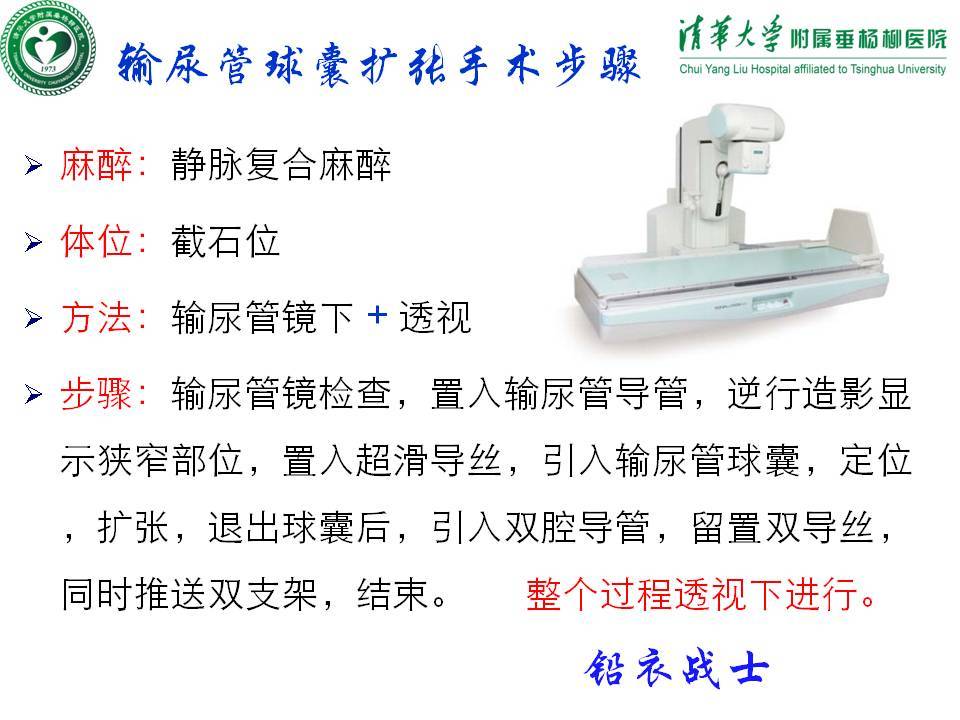 输尿管扩张器使用图解图片