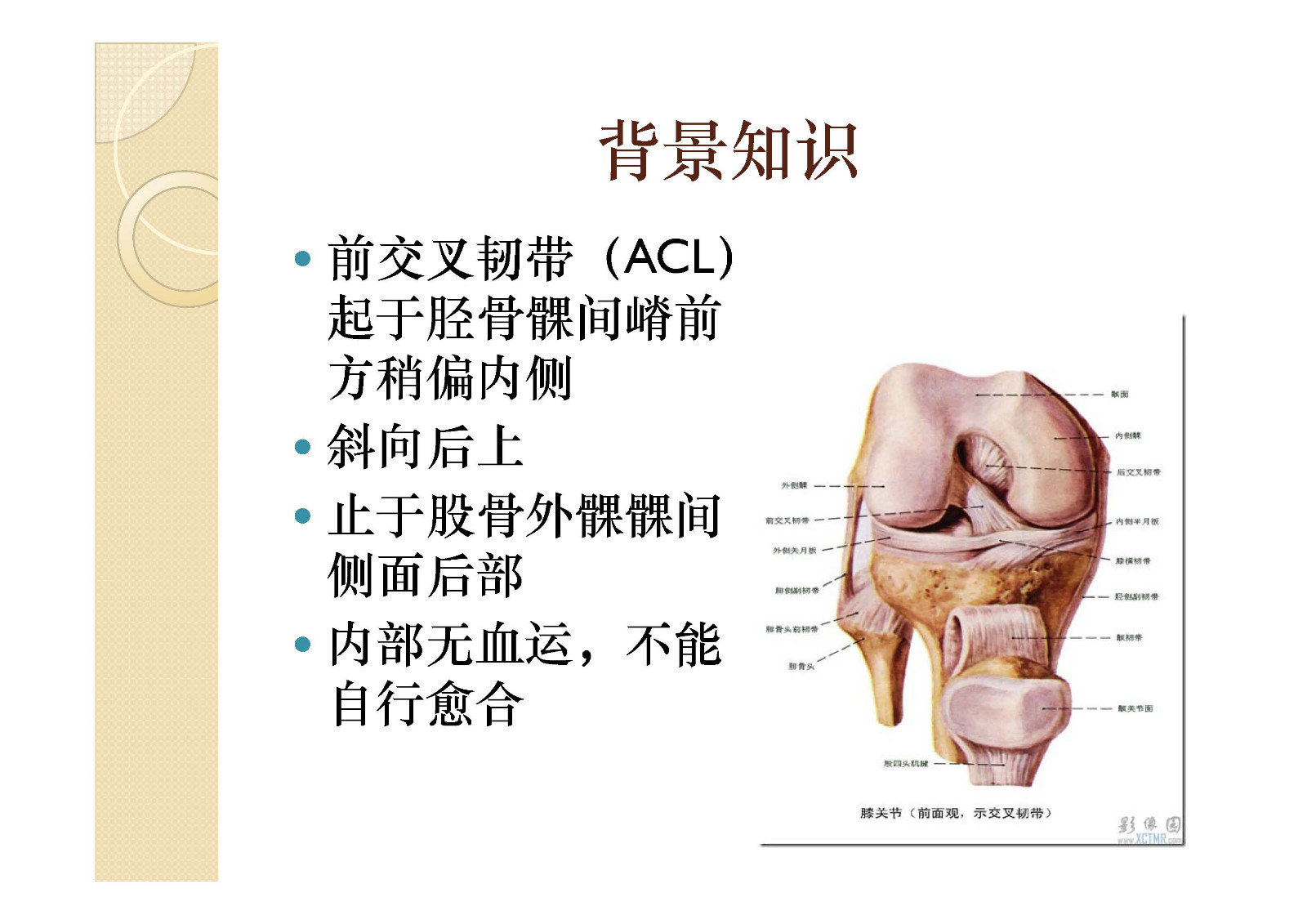 前交叉韧带示意图图片