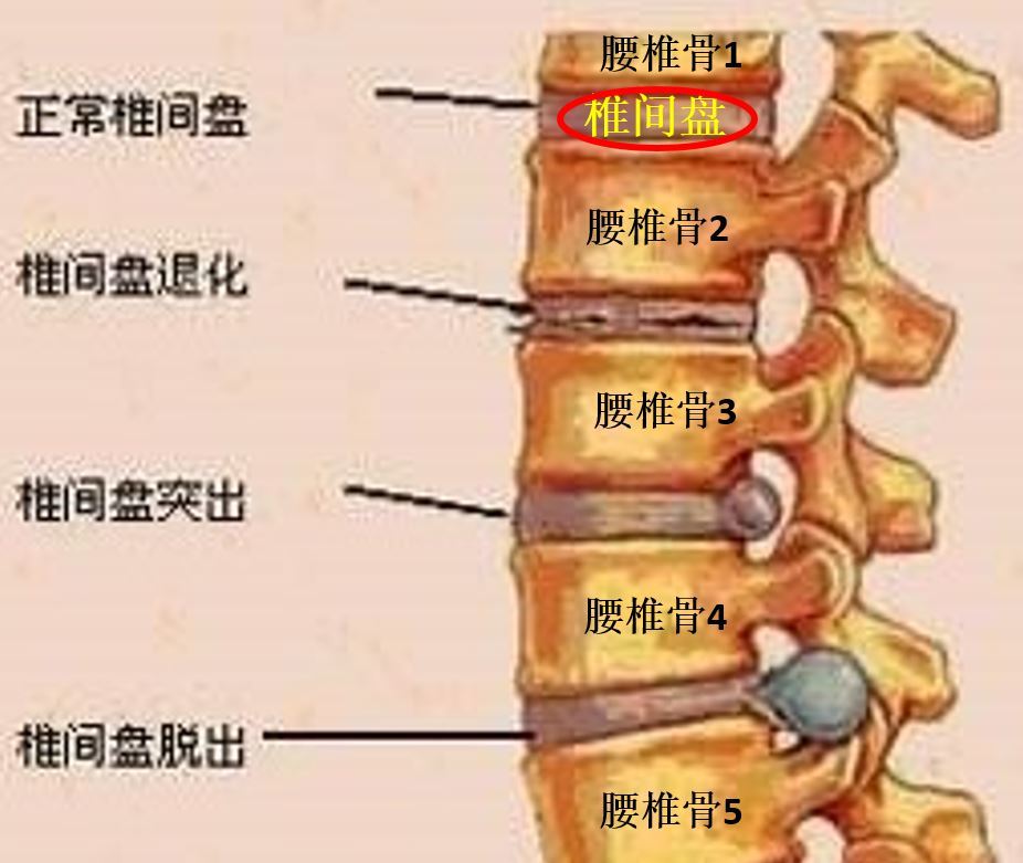 人的腰椎分5个节段,在腰椎和腰椎之间就是椎间盘(如下图)