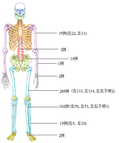 骨肉瘤发病率图片