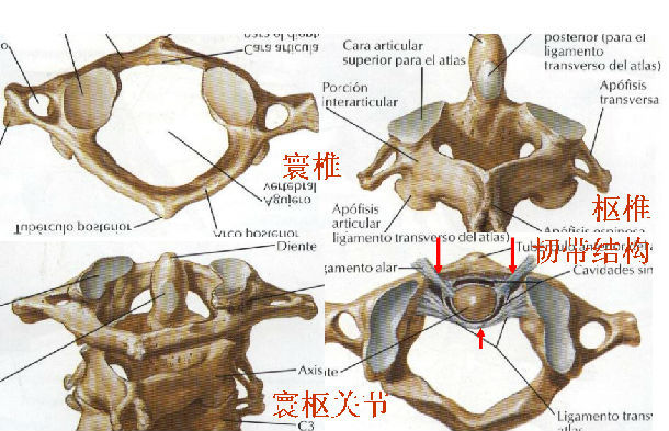 话说儿童寰枢关节半脱位