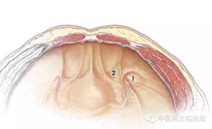 腹股沟斜疝b超图片